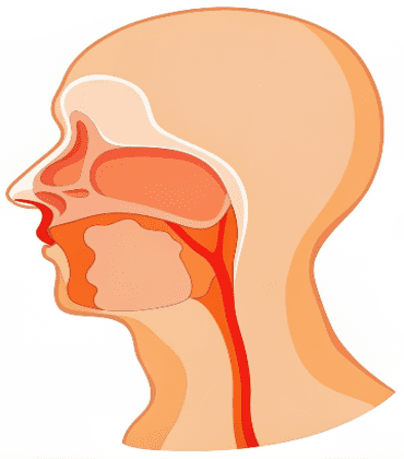 Invasive Lobular Carcinoma (ILC)